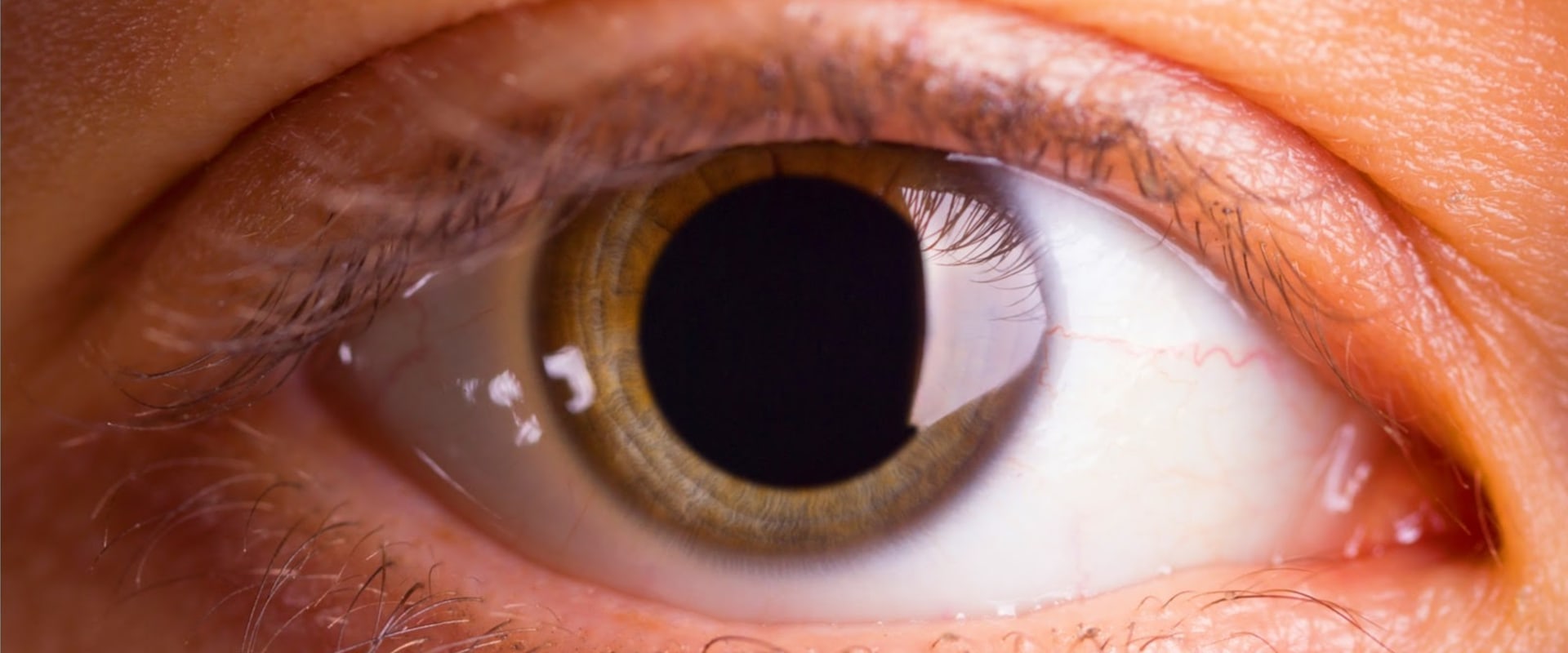 What Should You Avoid After Having Your Eyes Dilated?