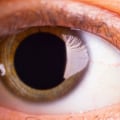 Do You Need to Get Your Eyes Dilated During an Eye Exam?