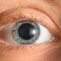Do You Always Need Eye Dilation for an Eye Exam?
