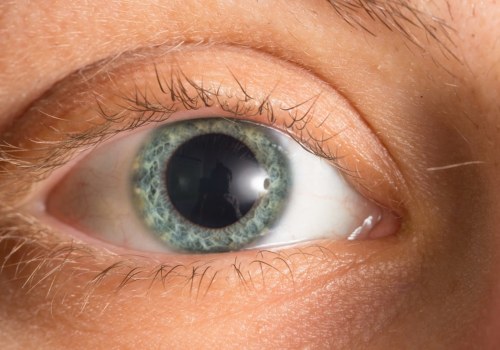 Do You Always Need Eye Dilation for an Eye Exam?